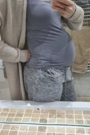 人们以为这个女人已经怀孕7个月了,但事实并非如此