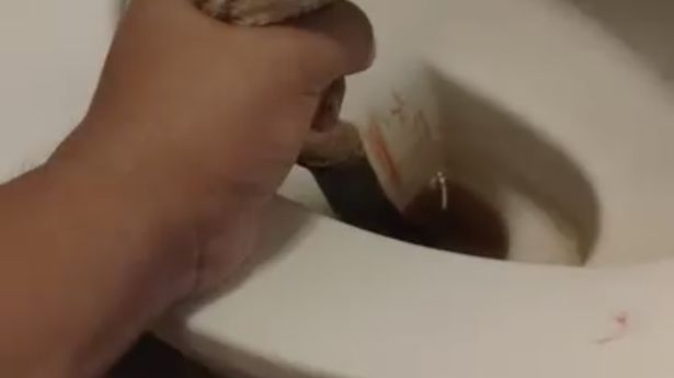 在噩梦般的恐怖场景中，蟒蛇爬上厕所，咬了家伙的蛋蛋