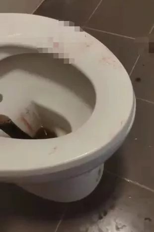 在噩梦般的恐怖场景中,蟒蛇爬上厕所,咬了家伙的蛋蛋